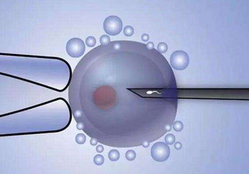 2022南通第三代試管嬰兒價格多少？