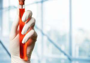 現在美國試管嬰兒的費用是多少