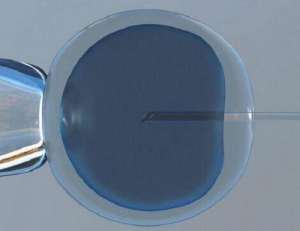 美國和泰國試管嬰兒哪個好