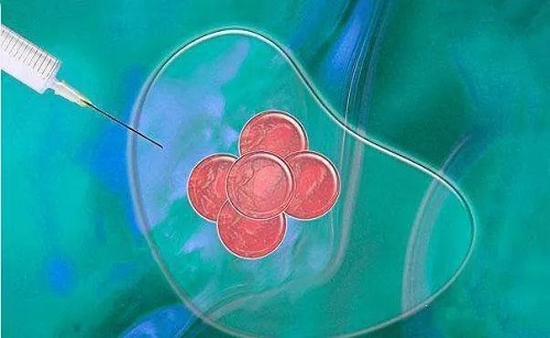 泰國試管嬰兒存在失敗風險嗎