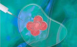 泰國試管嬰兒存在失敗風險嗎