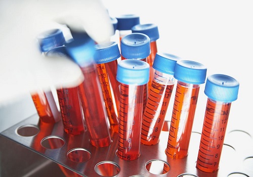 生子做第三代試管的費用