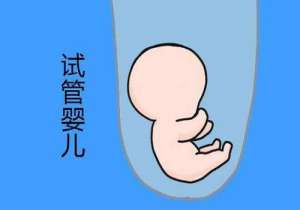 怎樣去美國做試管嬰兒
