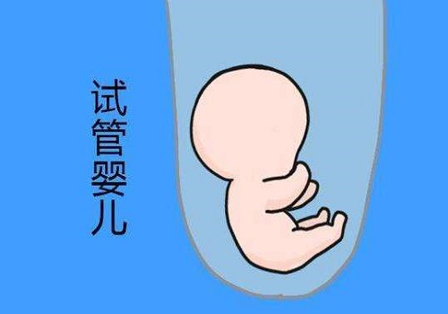 怎樣去美國做試管嬰兒