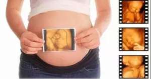 美國試管嬰兒最好醫院如何評判