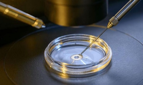 俄羅斯試管嬰兒技術怎么樣