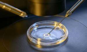 俄羅斯試管嬰兒技術怎么樣