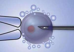 選擇俄羅斯試管嬰兒方向中介機構的方法